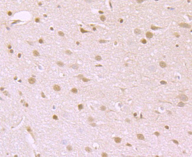 ATP Citrate Lyase Antibody in Immunohistochemistry (Paraffin) (IHC (P))