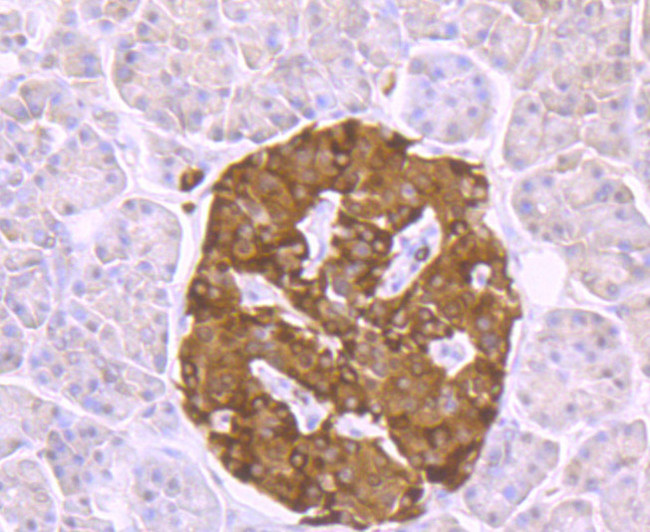 ATP Citrate Lyase Antibody in Immunohistochemistry (Paraffin) (IHC (P))