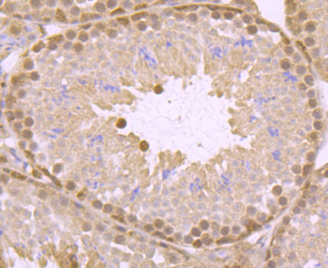 ATP Citrate Lyase Antibody in Immunohistochemistry (Paraffin) (IHC (P))