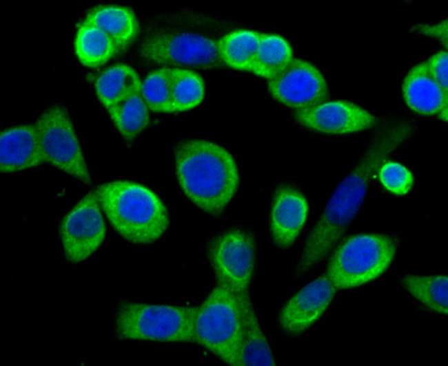 MMP3 Antibody in Immunocytochemistry (ICC/IF)