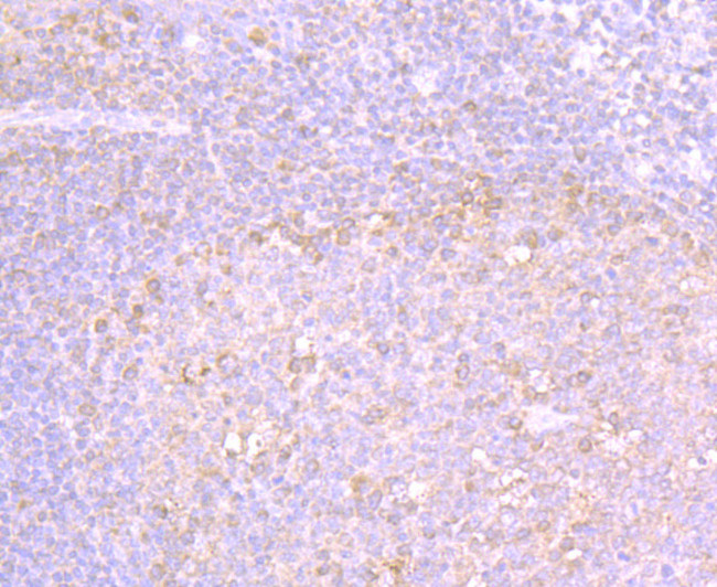 MMP3 Antibody in Immunohistochemistry (Paraffin) (IHC (P))