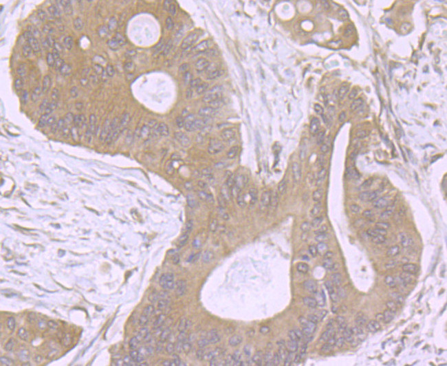 MMP3 Antibody in Immunohistochemistry (Paraffin) (IHC (P))