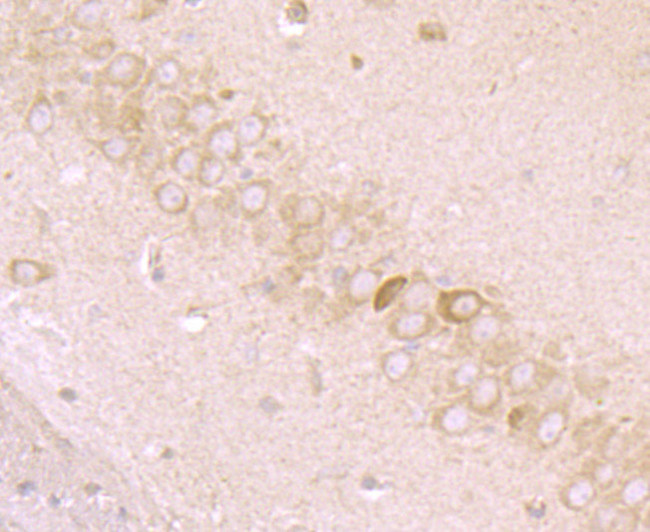 MMP3 Antibody in Immunohistochemistry (Paraffin) (IHC (P))