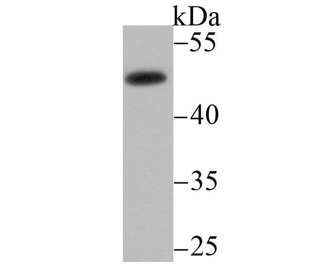 MMP3 Antibody in Western Blot (WB)