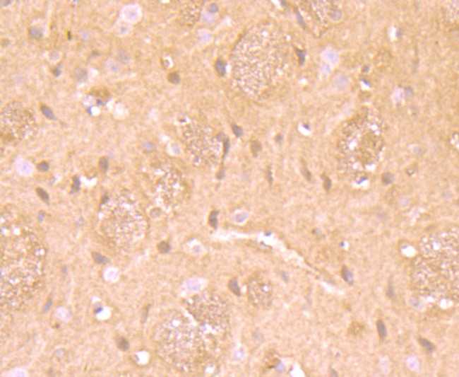 RARA Antibody in Immunohistochemistry (Paraffin) (IHC (P))