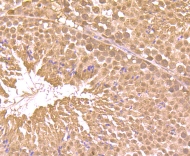 RARA Antibody in Immunohistochemistry (Paraffin) (IHC (P))