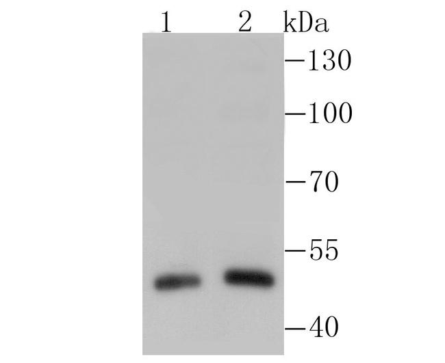 RARA Antibody in Western Blot (WB)