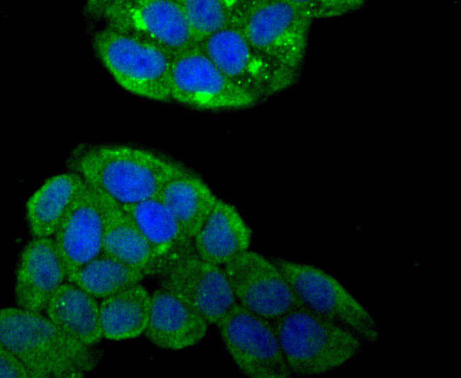 SMAD4 Antibody in Immunocytochemistry (ICC/IF)