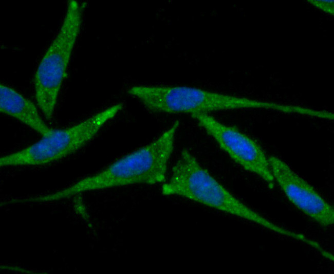 SMAD4 Antibody in Immunocytochemistry (ICC/IF)