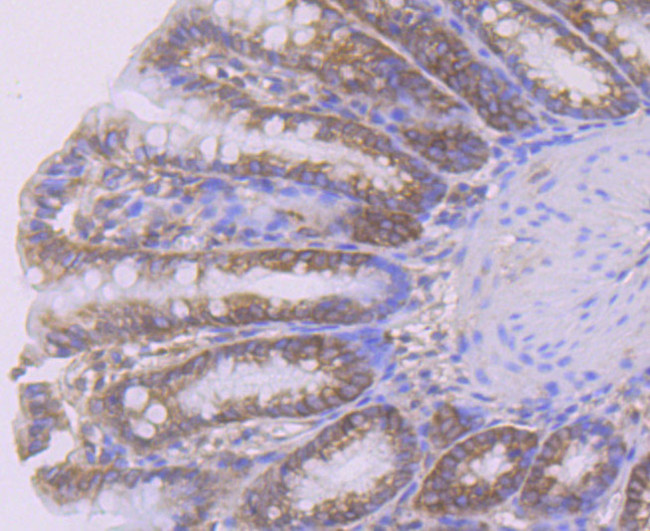 SMAD4 Antibody in Immunohistochemistry (Paraffin) (IHC (P))