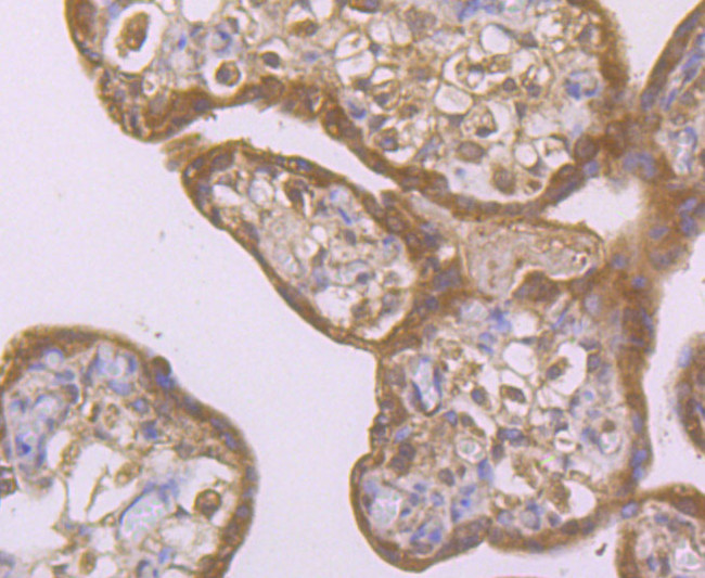 SMAD4 Antibody in Immunohistochemistry (Paraffin) (IHC (P))