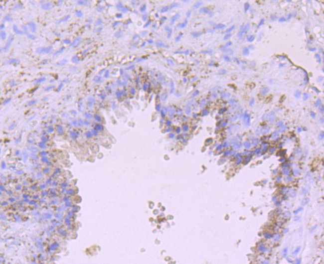 ADAM10 Antibody in Immunohistochemistry (Paraffin) (IHC (P))