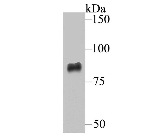 ADAM10 Antibody in Western Blot (WB)