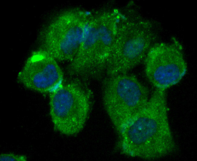 beta Arrestin 1 Antibody in Immunocytochemistry (ICC/IF)