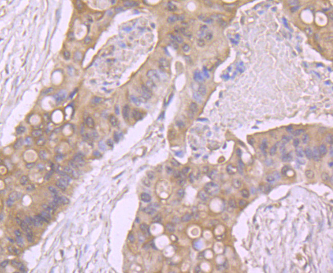 beta Arrestin 1 Antibody in Immunohistochemistry (Paraffin) (IHC (P))