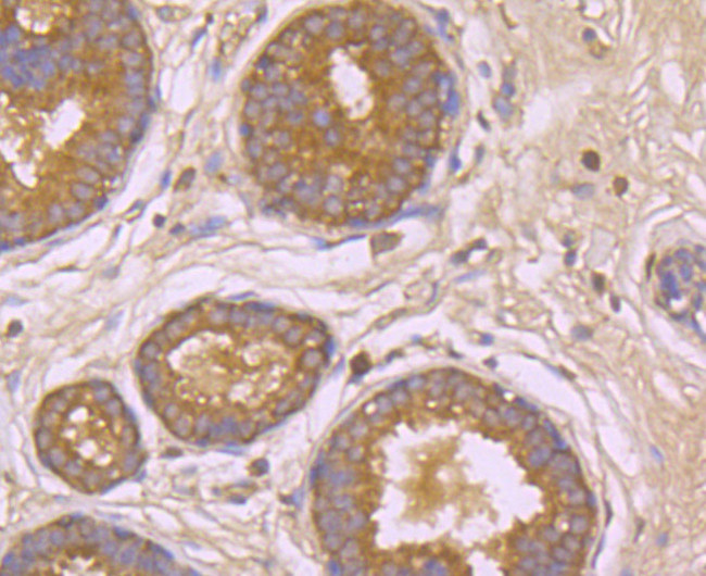 beta Arrestin 1 Antibody in Immunohistochemistry (Paraffin) (IHC (P))