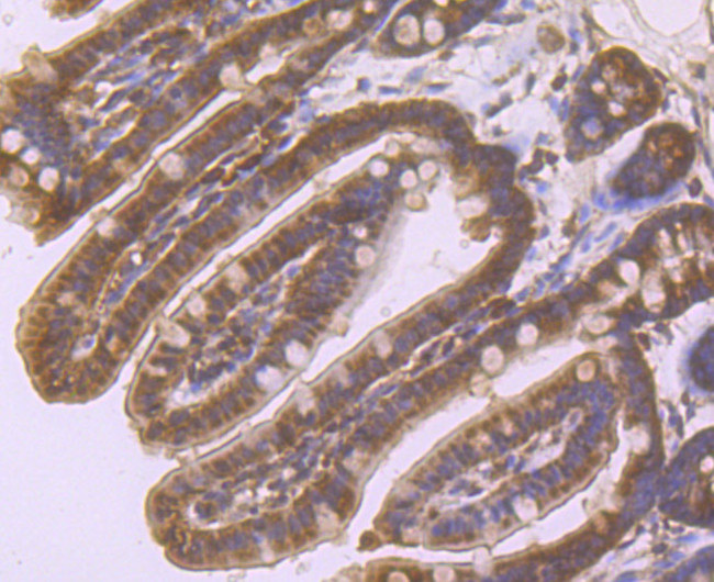 beta Arrestin 1 Antibody in Immunohistochemistry (Paraffin) (IHC (P))