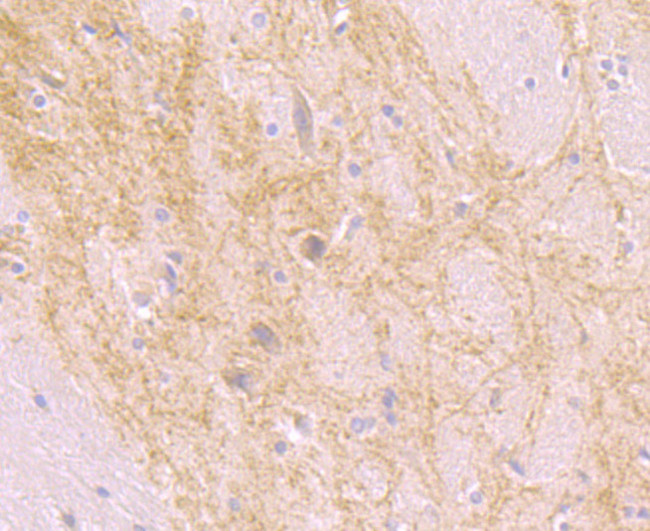 beta Arrestin 1 Antibody in Immunohistochemistry (Paraffin) (IHC (P))