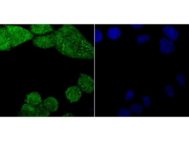 PKC beta Antibody in Immunocytochemistry (ICC/IF)