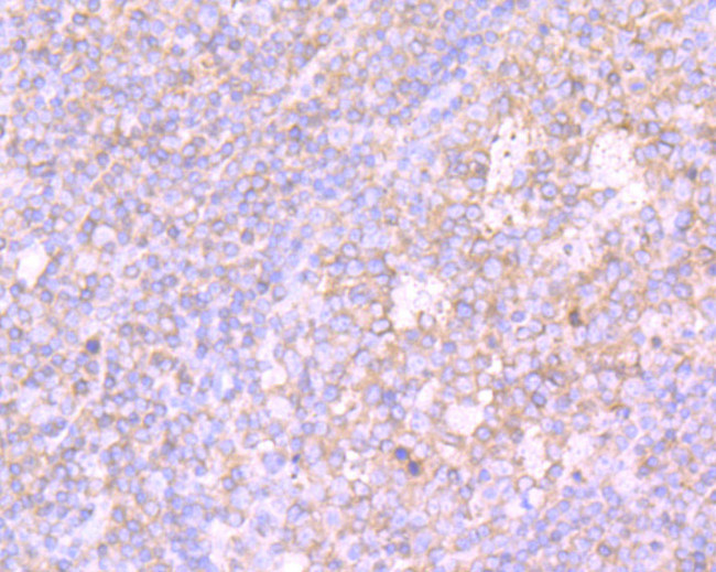 PKC beta Antibody in Immunohistochemistry (Paraffin) (IHC (P))