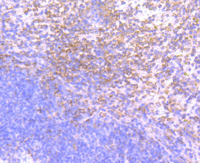 PKC beta Antibody in Immunohistochemistry (Paraffin) (IHC (P))