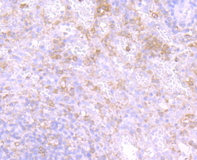 PKC beta Antibody in Immunohistochemistry (Paraffin) (IHC (P))