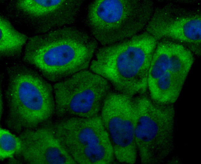 MFN2 Antibody in Immunocytochemistry (ICC/IF)