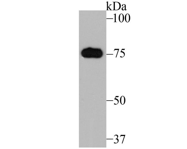 MFN2 Antibody in Western Blot (WB)