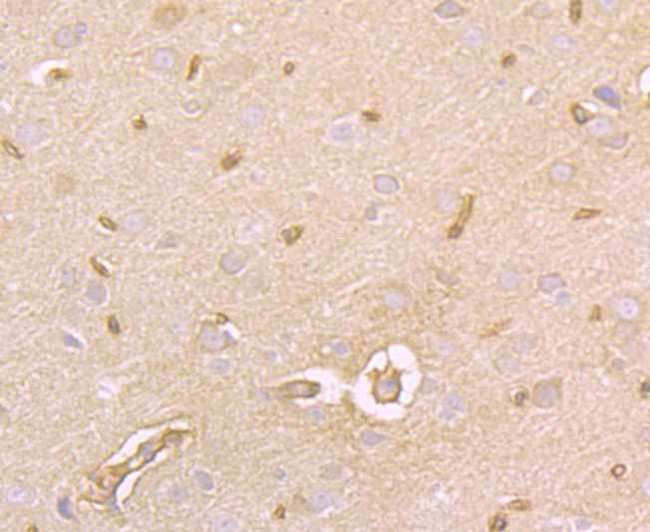 Protein APC Antibody in Immunohistochemistry (Paraffin) (IHC (P))