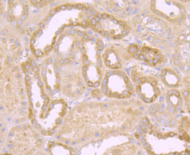 Protein APC Antibody in Immunohistochemistry (Paraffin) (IHC (P))