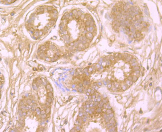 Protein APC Antibody in Immunohistochemistry (Paraffin) (IHC (P))