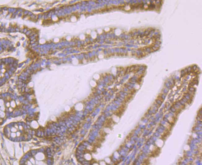 Protein APC Antibody in Immunohistochemistry (Paraffin) (IHC (P))