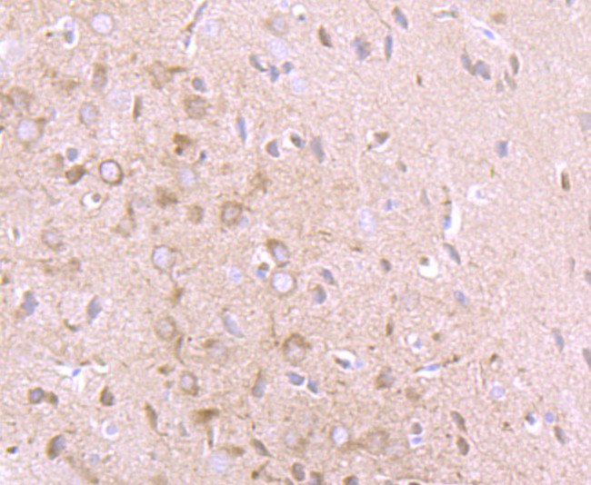 IFN alpha Antibody in Immunohistochemistry (Paraffin) (IHC (P))