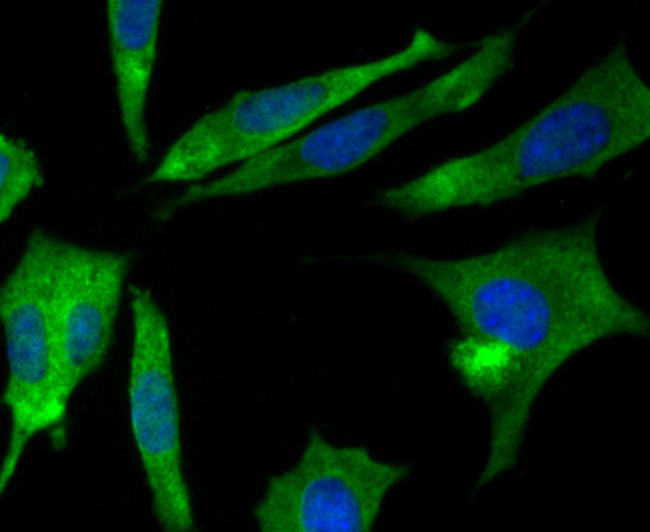 CRMP2 Antibody in Immunocytochemistry (ICC/IF)