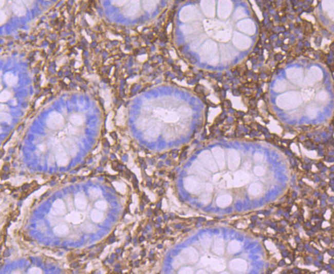 CRMP2 Antibody in Immunohistochemistry (Paraffin) (IHC (P))