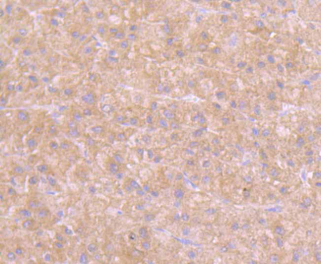 GOT1 Antibody in Immunohistochemistry (Paraffin) (IHC (P))