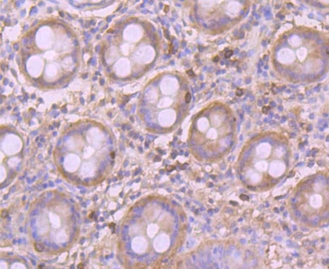 GOT1 Antibody in Immunohistochemistry (Paraffin) (IHC (P))