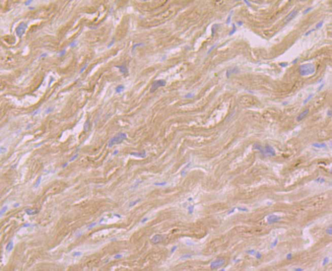 GOT1 Antibody in Immunohistochemistry (Paraffin) (IHC (P))