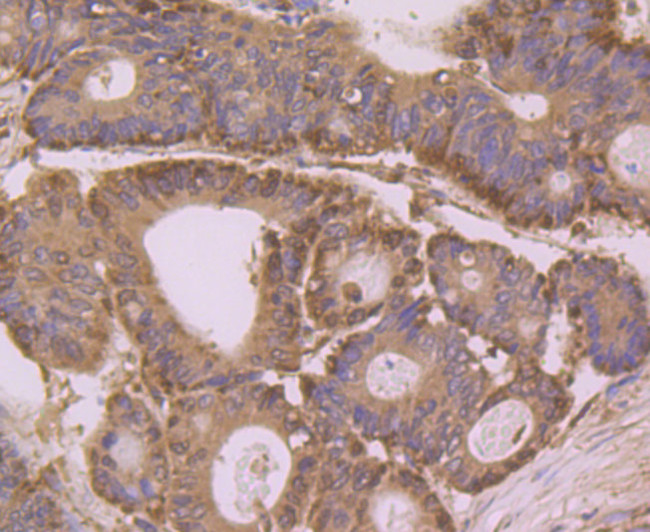 Annexin A3 Antibody in Immunohistochemistry (Paraffin) (IHC (P))