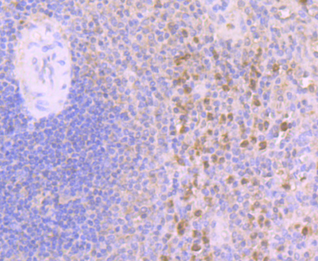 Annexin A3 Antibody in Immunohistochemistry (Paraffin) (IHC (P))