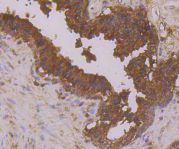 Annexin A3 Antibody in Immunohistochemistry (Paraffin) (IHC (P))