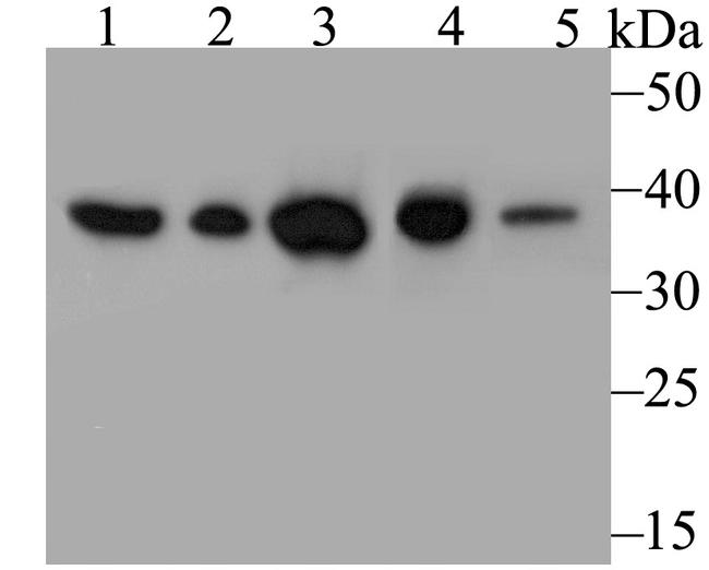 Annexin A3 Antibody in Western Blot (WB)