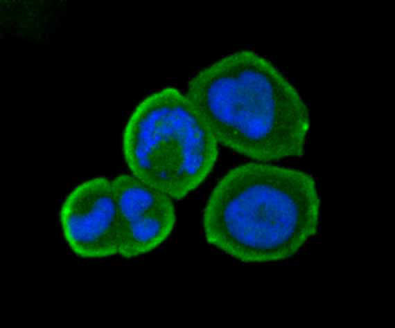 B7-H4 Antibody in Immunocytochemistry (ICC/IF)