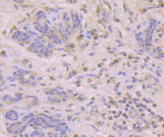 B7-H4 Antibody in Immunohistochemistry (Paraffin) (IHC (P))