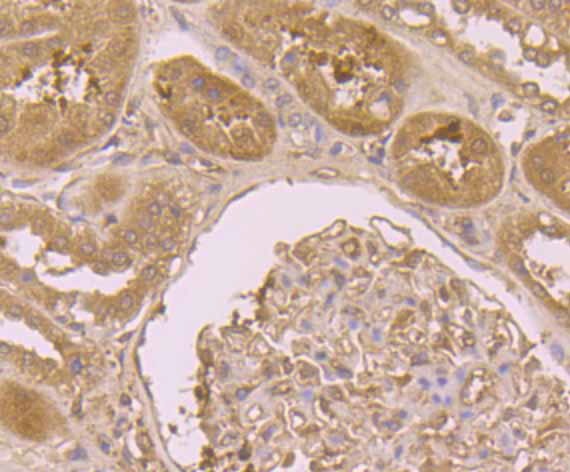 B7-H4 Antibody in Immunohistochemistry (Paraffin) (IHC (P))