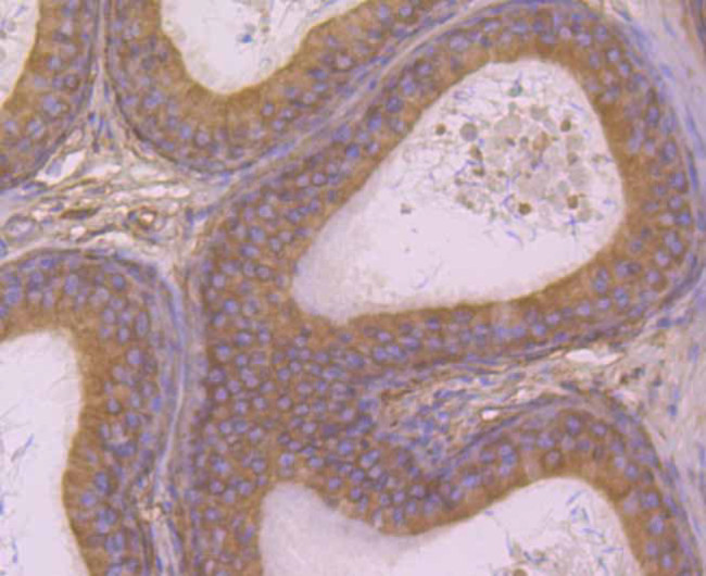 B7-H4 Antibody in Immunohistochemistry (Paraffin) (IHC (P))