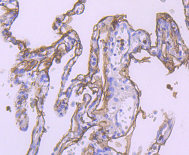 TROP2 Antibody in Immunohistochemistry (Paraffin) (IHC (P))