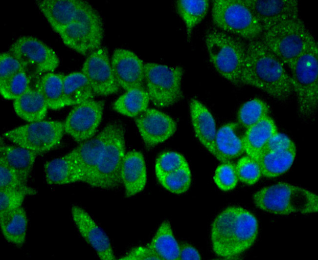 Carbonic anhydrase II Antibody in Immunocytochemistry (ICC/IF)