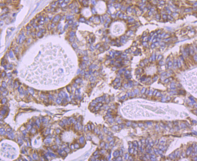 Carbonic anhydrase II Antibody in Immunohistochemistry (Paraffin) (IHC (P))