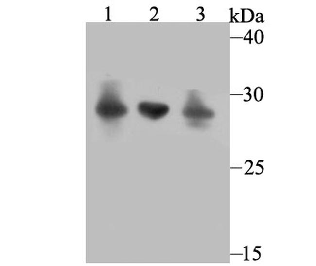 Carbonic anhydrase II Antibody in Western Blot (WB)